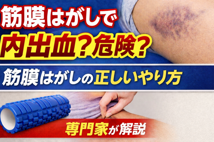 筋膜はがしで内出血は危険なのかを解説するイメージ。フォームローラーと筋膜リリースのセルフケア方法を紹介