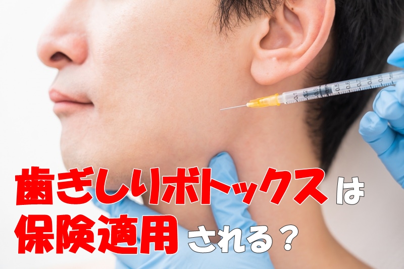 歯ぎしりボトックスは保険適用される？