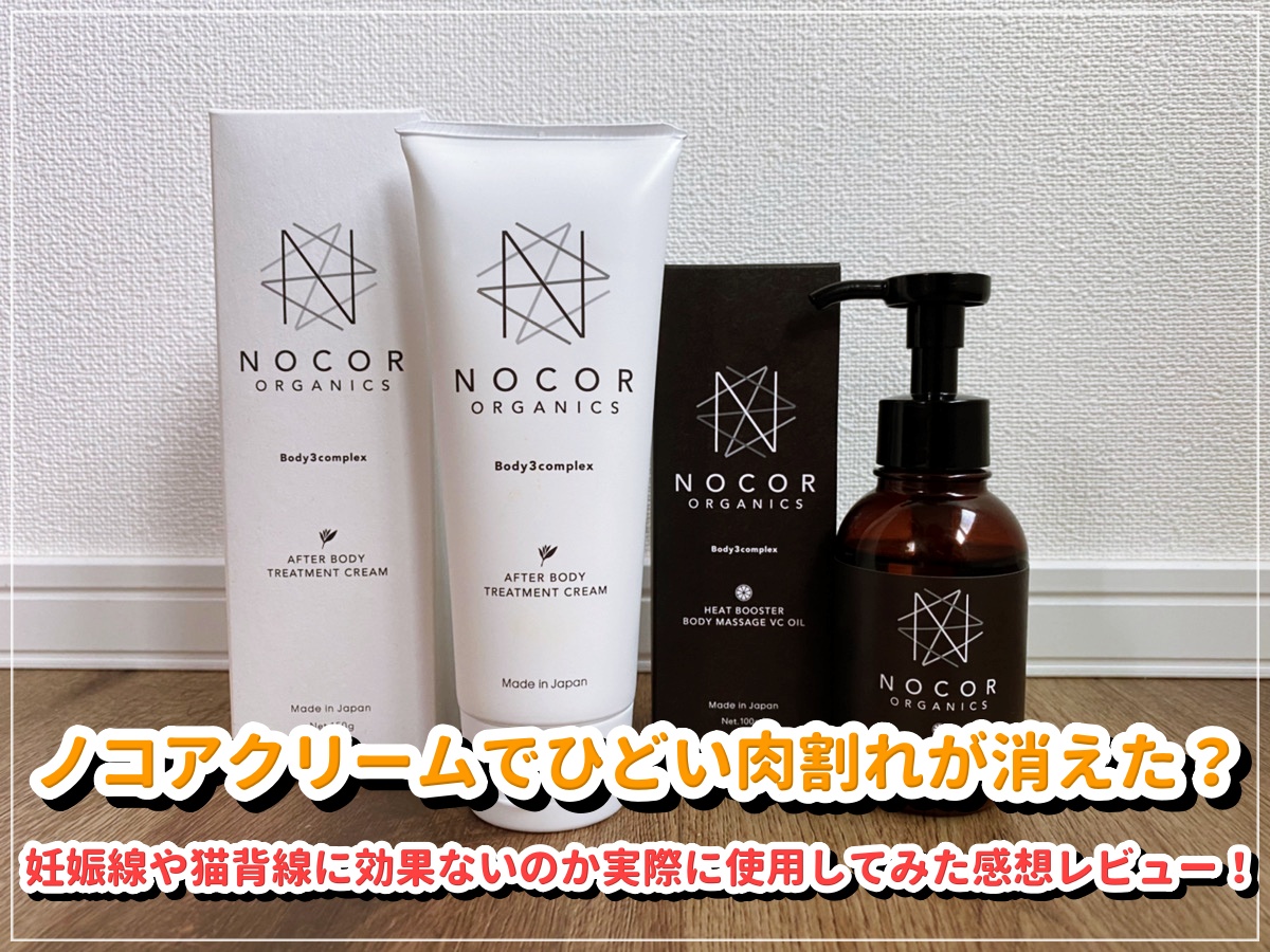 妊娠線対策クリーム　NOCOR ノコア VCオイル2本 （バラ売り可） ノコアクリームでひどい肉割れが消えた？妊娠線や猫背線に効果ないのか
